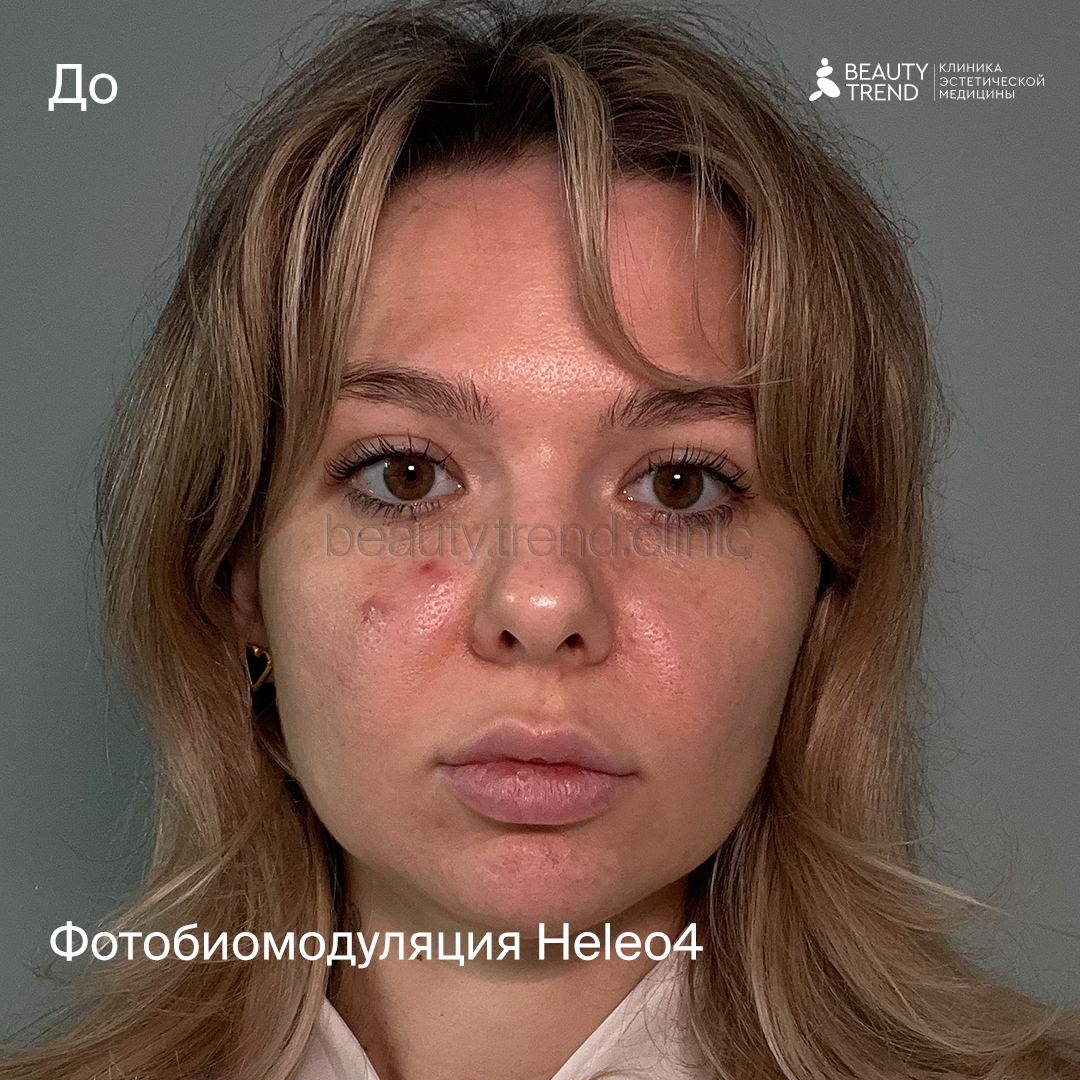HELEO4 - до 1